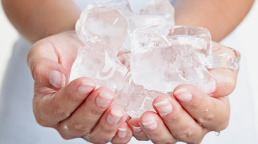 Криотерапия